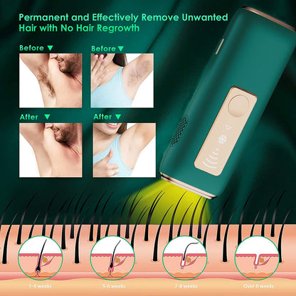 Hair Removal Laser